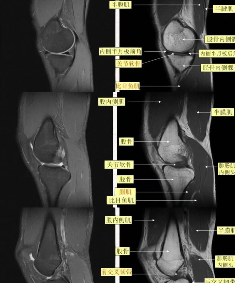 膝关节图片结构图以及功能
